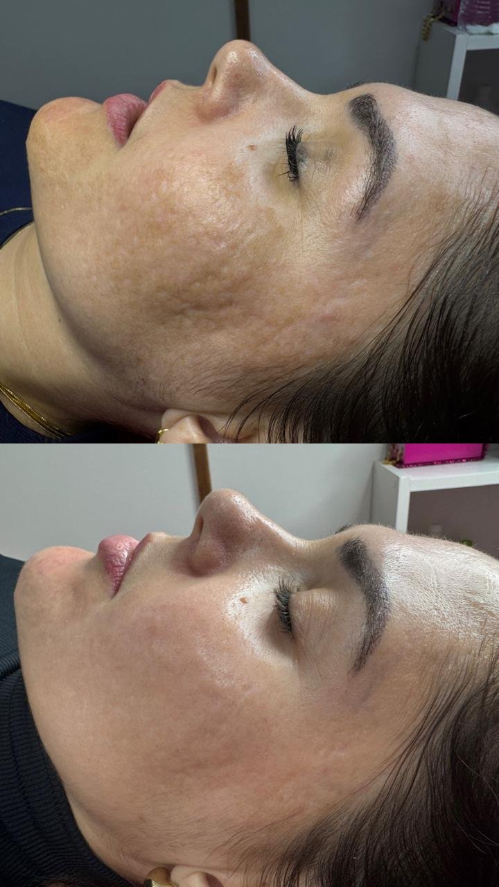Foto 4 do trabalho do Pacheco Studio de Beleza